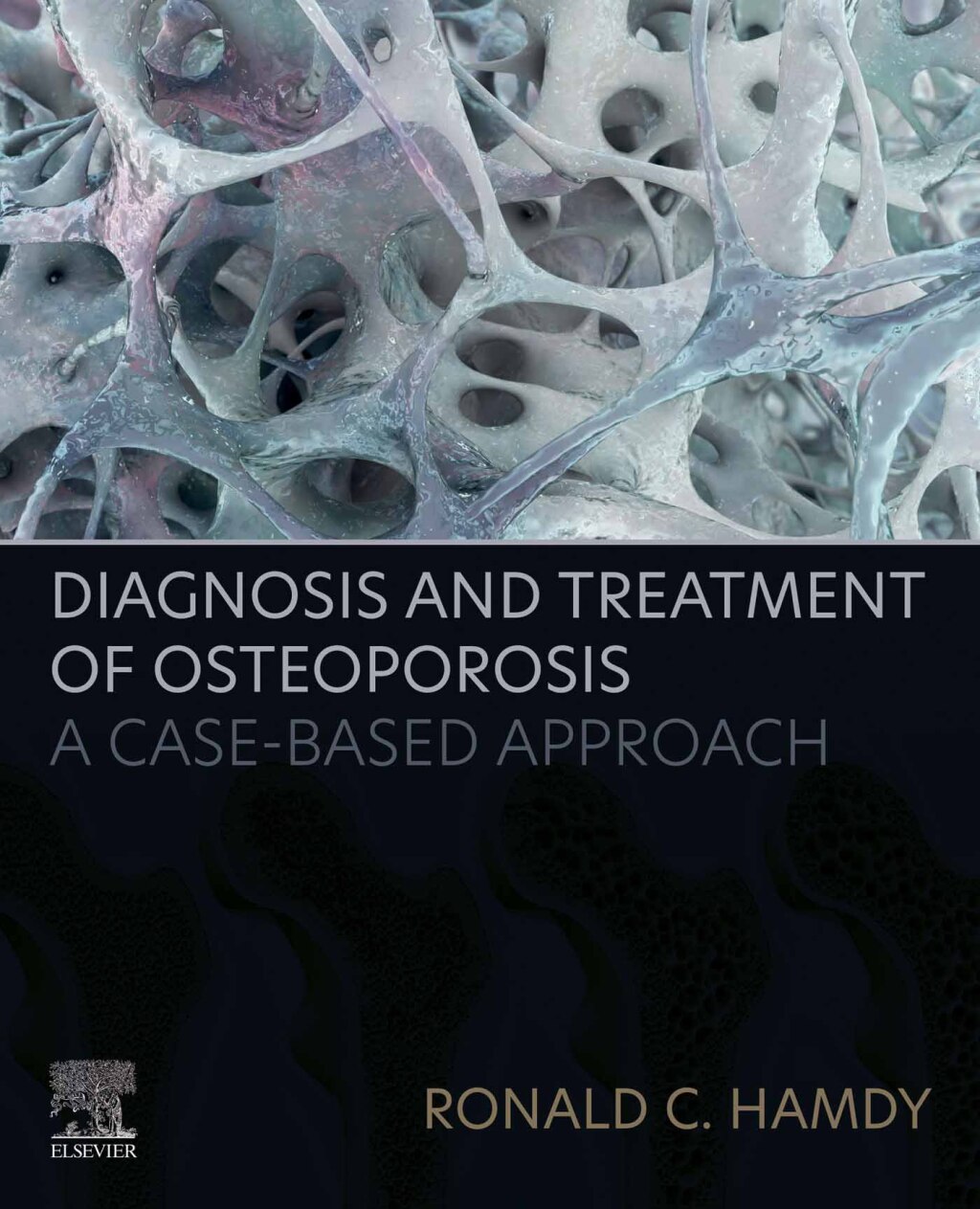 Diagnosis and Treatment of Osteoporosis A Case-Based Approach 1st Edition