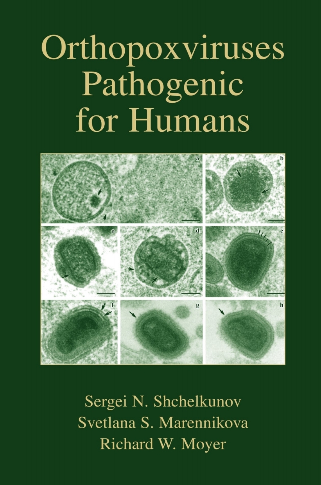 Orthopoxviruses Pathogenic for Humans 1st Edition