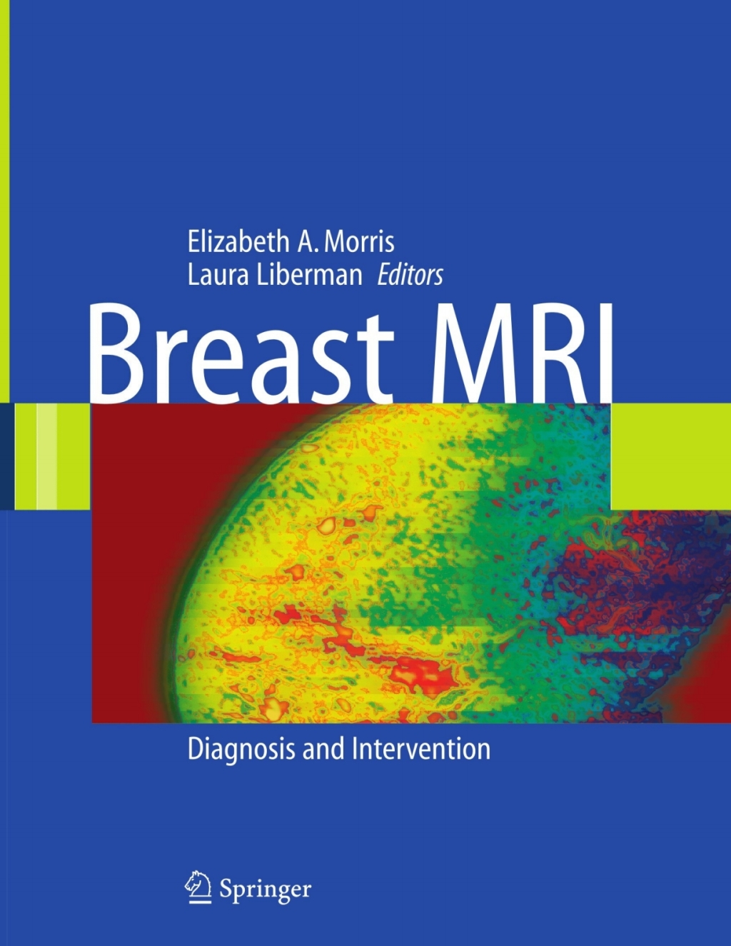 Breast MRI Diagnosis and Intervention 1st Edition