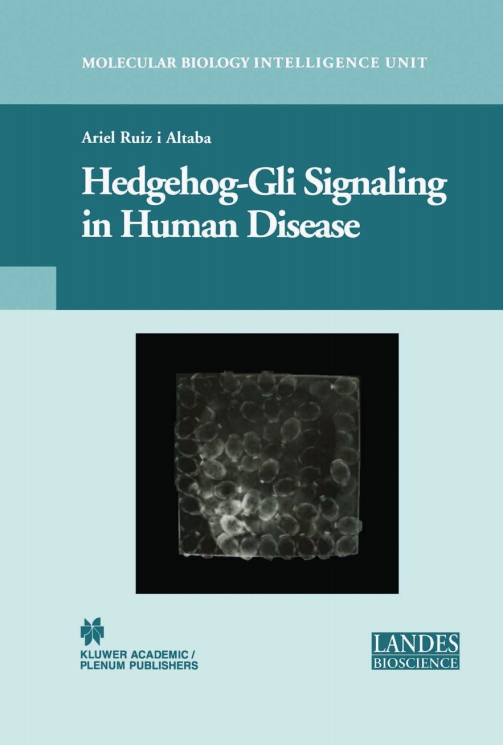 Hedgehog-Gli Signaling in Human Disease 1st Edition