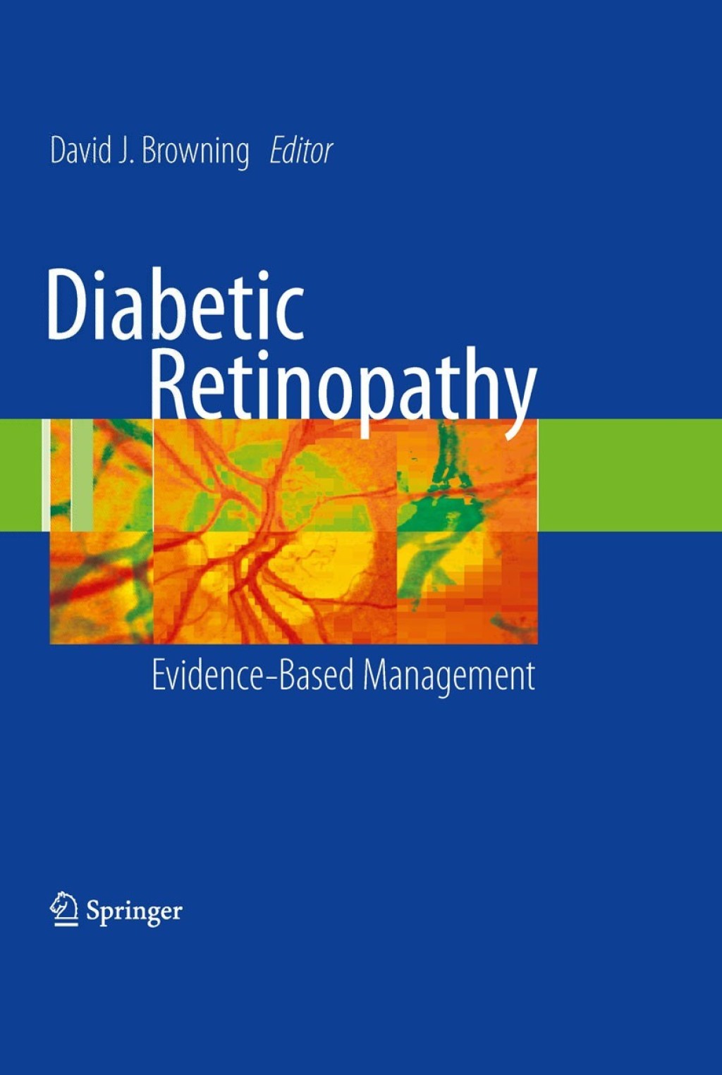 Diabetic Retinopathy Evidence-Based Management 1st Edition