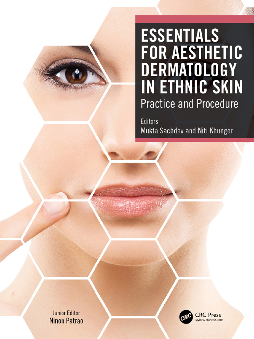Essentials for Aesthetic Dermatology in Ethnic Skin Practice and Procedure 1st Edition