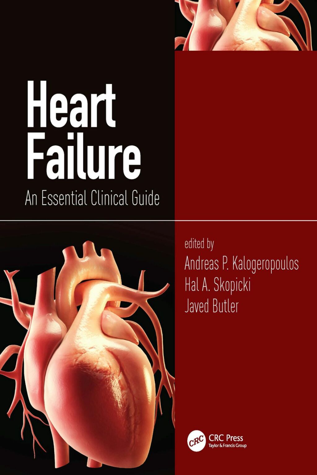 Heart Failure An Essential Clinical Guide 1st Edition