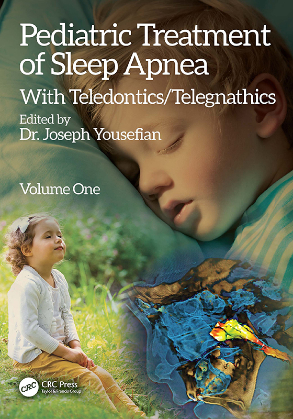 Pediatric Treatment of Sleep Apnea With Teledontics/Telegnathics 1st Edition