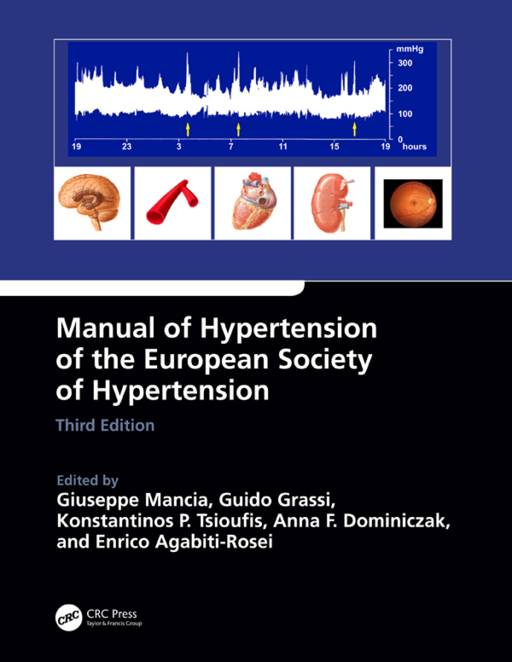 Manual of Hypertension of the European Society of Hypertension 3rd Edition