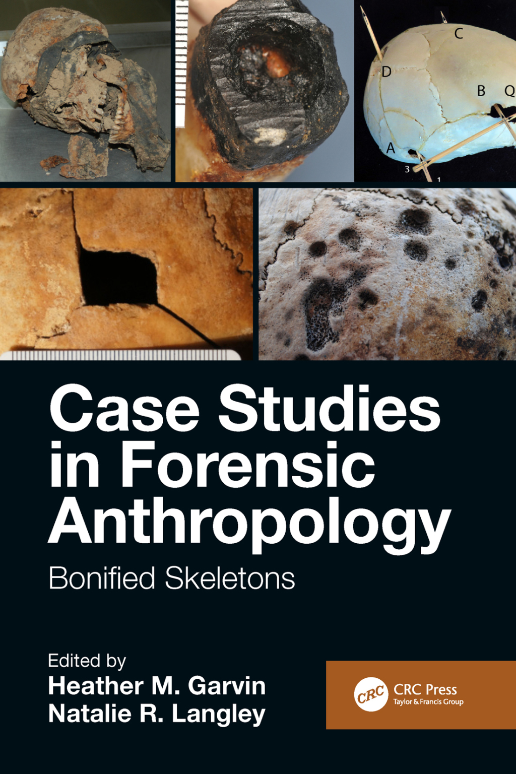 Case Studies in Forensic Anthropology Bonified Skeletons 1st Edition