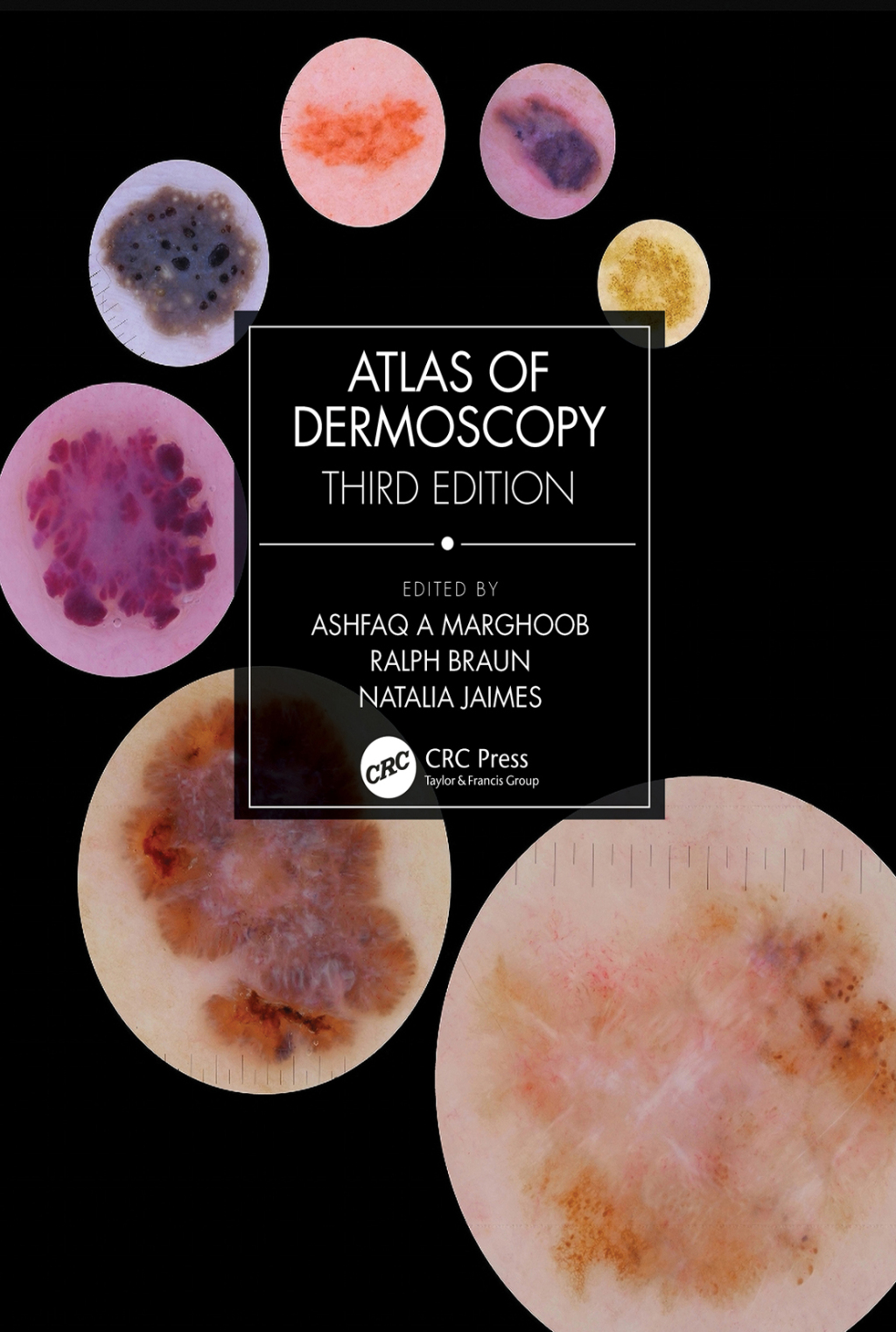 Atlas of Dermoscopy Third Edition 3rd Edition
