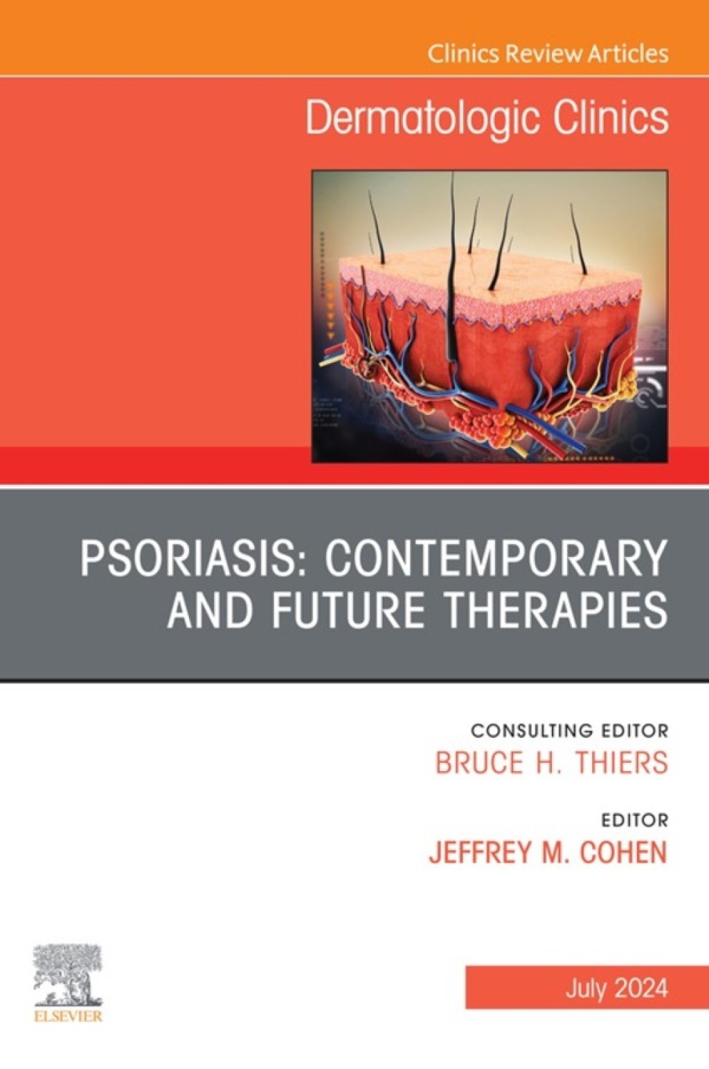 Psoriasis: Contemporary and Future Therapies, An Issue of Dermatologic Clinics 1st Edition