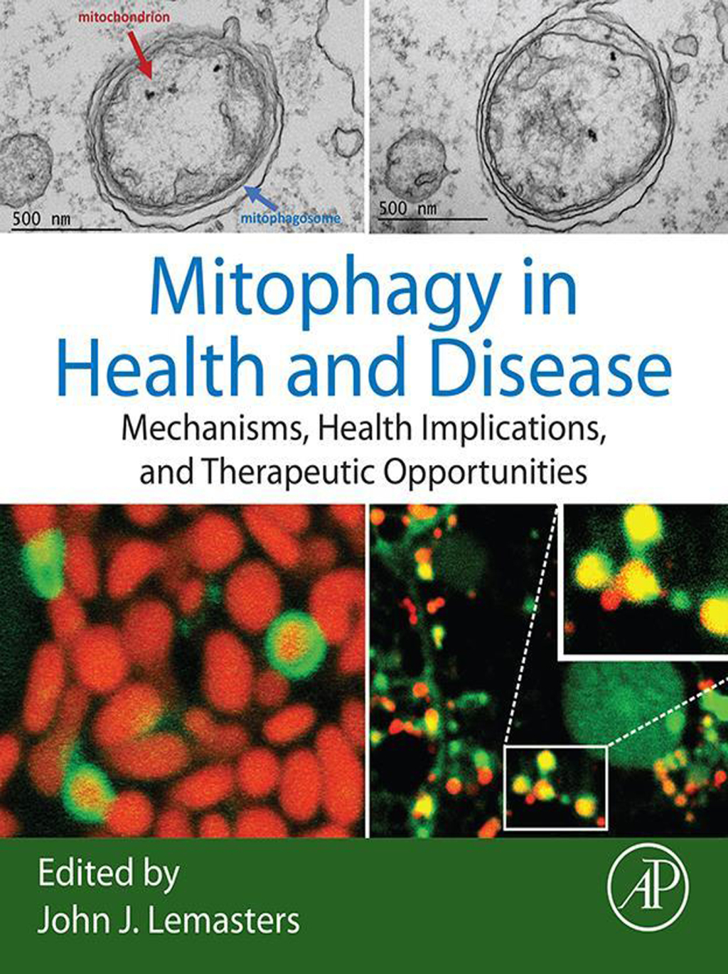 Mitophagy in Health and Disease Mechanisms, Health Implications, and Therapeutic Opportunities 