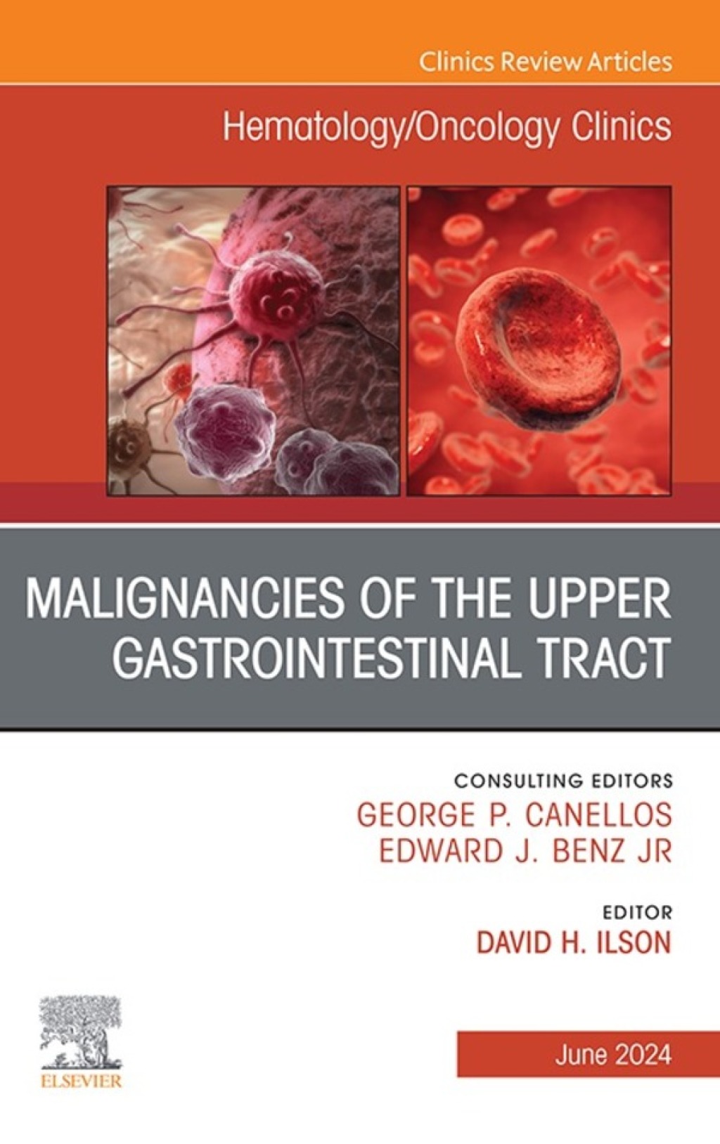 Malignancies of the Upper Gastrointestinal Tract, An Issue of Hematology/Oncology Clinics of North America 1st Edition
