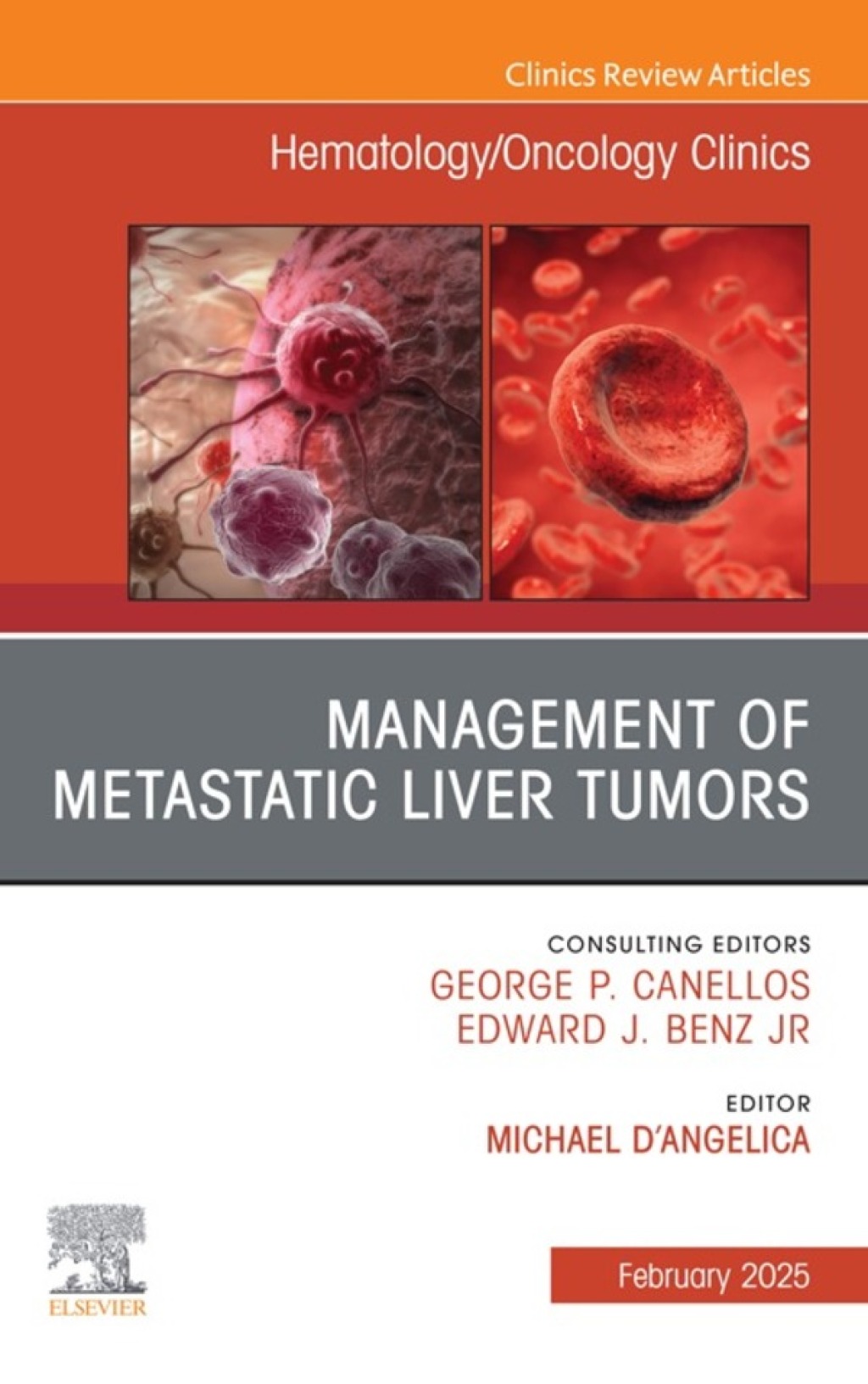 Management of Metastatic Liver Tumors, An Issue of Hematology/Oncology Clinics of North America 