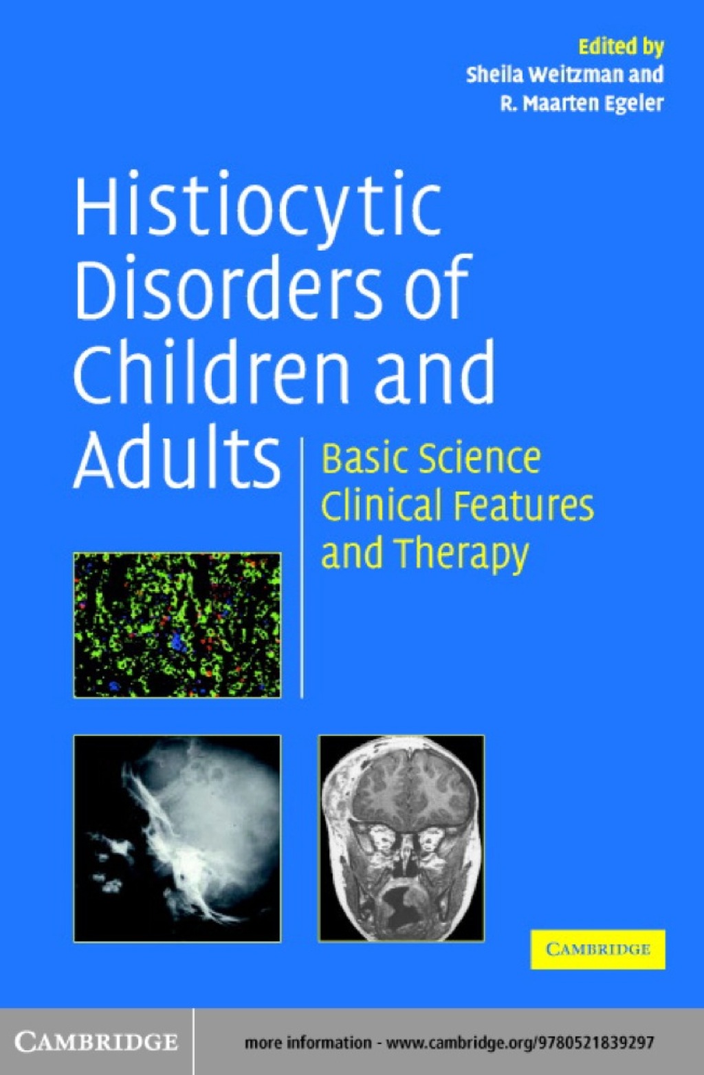 Histiocytic Disorders of Children and Adults Basic Science, Clinical Features and Therapy 1st Edition