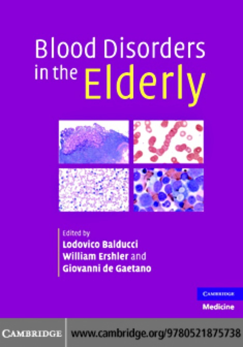 Blood Disorders in the Elderly 1st Edition