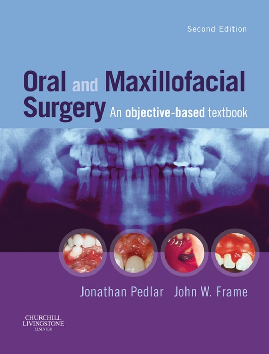 Oral and Maxillofacial Surgery An Objective-Based Textbook 2nd Edition