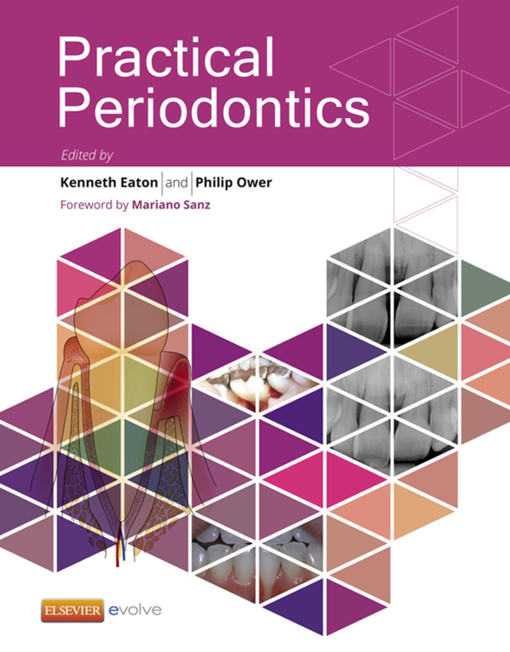 Practical Periodontics 