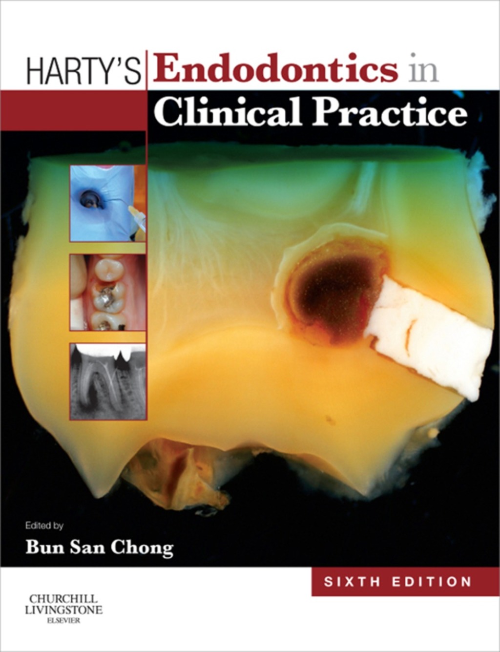 Harty's Endodontics in Clinical Practice 6th Edition