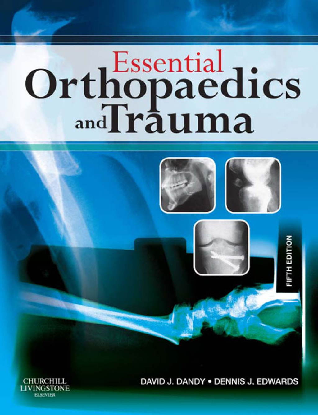 Essential Orthopaedics and Trauma - Electronic 5th Edition