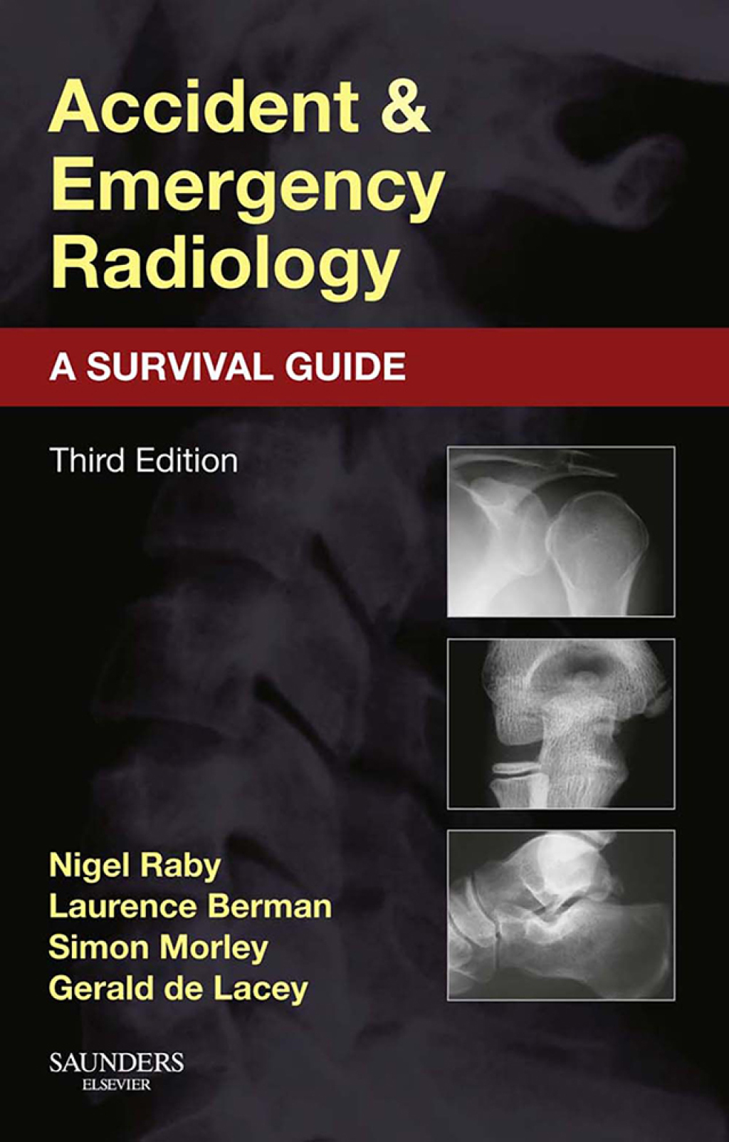 Accident and Emergency Radiology: A Survival Guide 3rd Edition