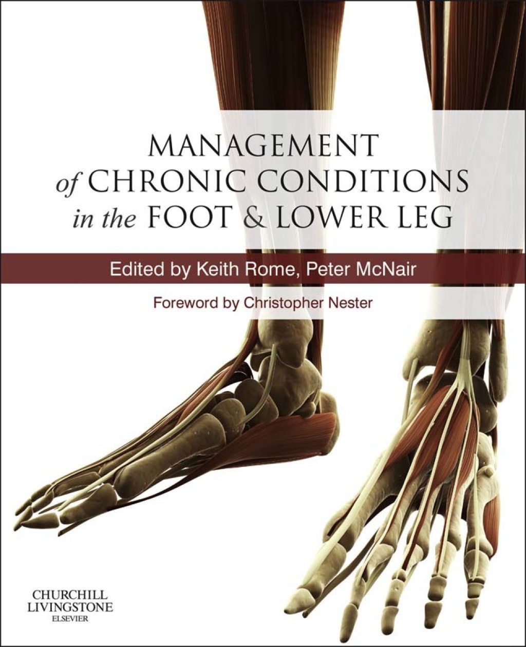 Management of Chronic Musculoskeletal Conditions in the Foot and Lower Leg 