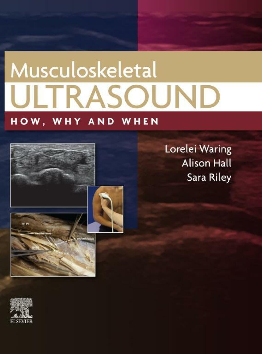 Musculoskeletal Ultrasound How, Why and When 