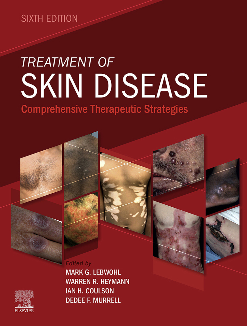 SPEC – Treatment of Skin Disease, 6th Edition, 12-Month Access, eBook Comprehensive Therapeutic Strategies 6th Edition
