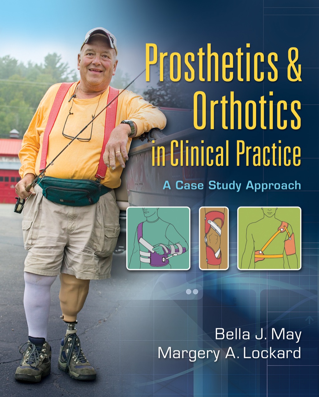 Prosthetics and Orthotics in Clinical Practice: A Case Study Approach 1st Edition