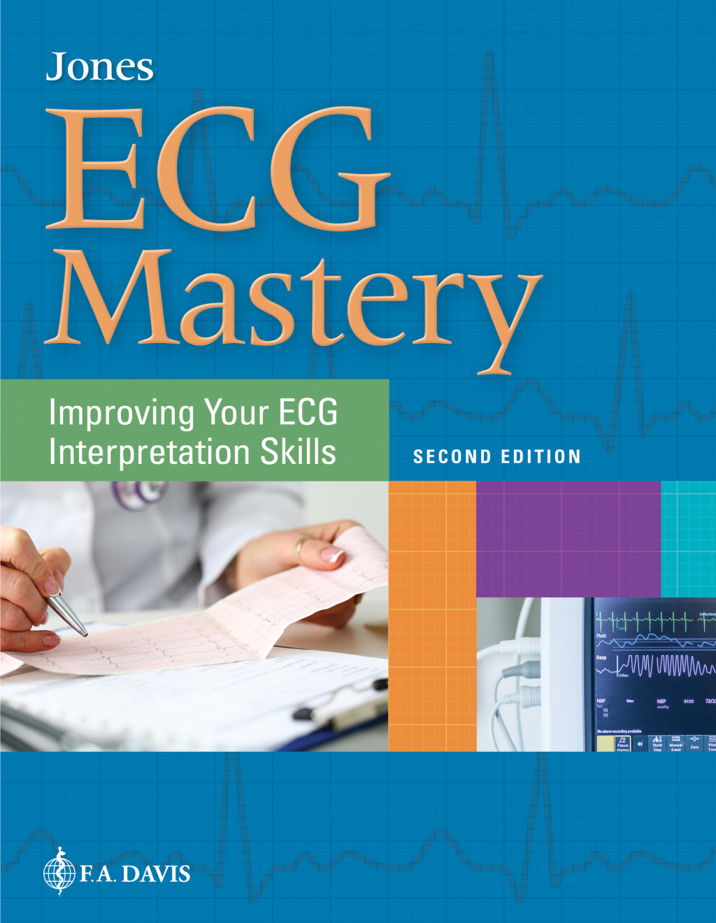ECG Mastery Improving Your ECG Interpretation Skills 2nd Edition