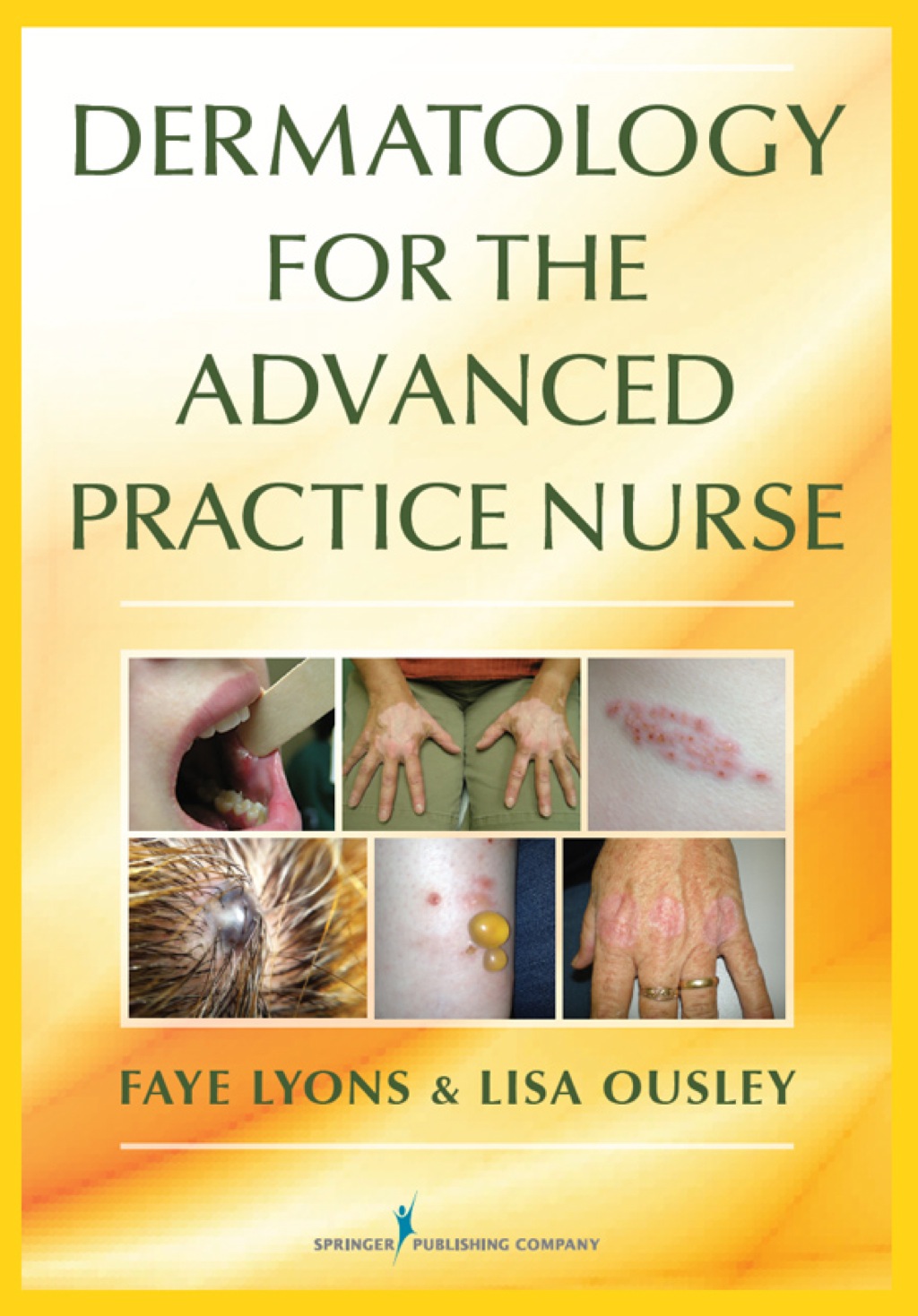 Dermatology for the Advanced Practice Nurse 1st Edition