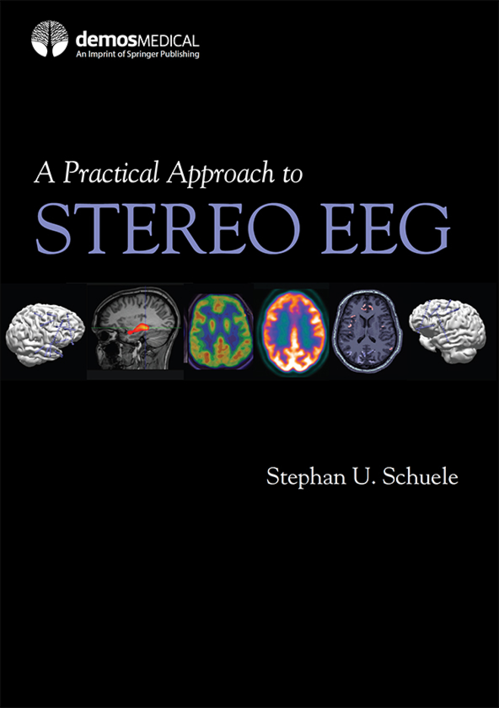 A Practical Approach to Stereo EEG 1st Edition