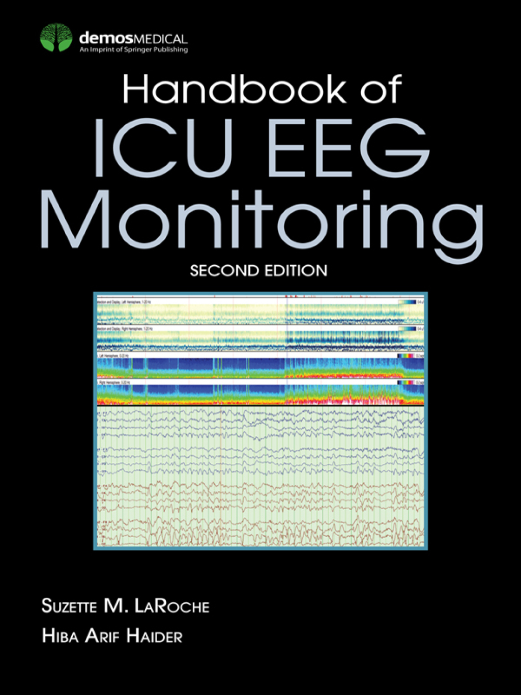 Handbook of ICU EEG Monitoring 2nd Edition