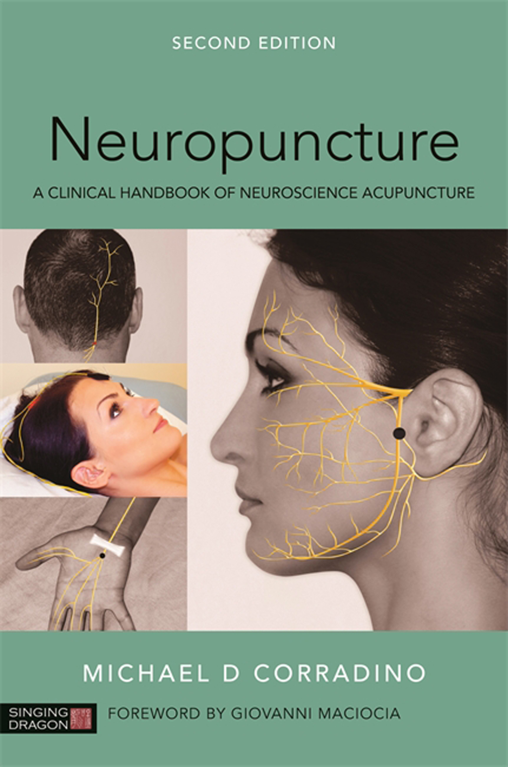 Neuropuncture A Clinical Handbook of Neuroscience Acupuncture, Second Edition 2nd Edition