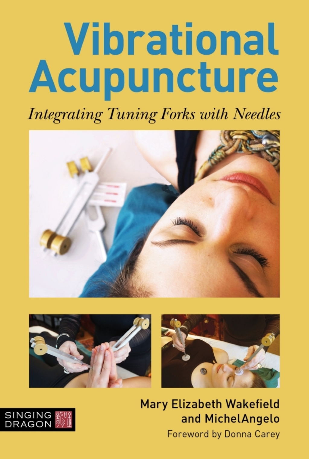 Vibrational Acupuncture Integrating Tuning Forks with Needles 