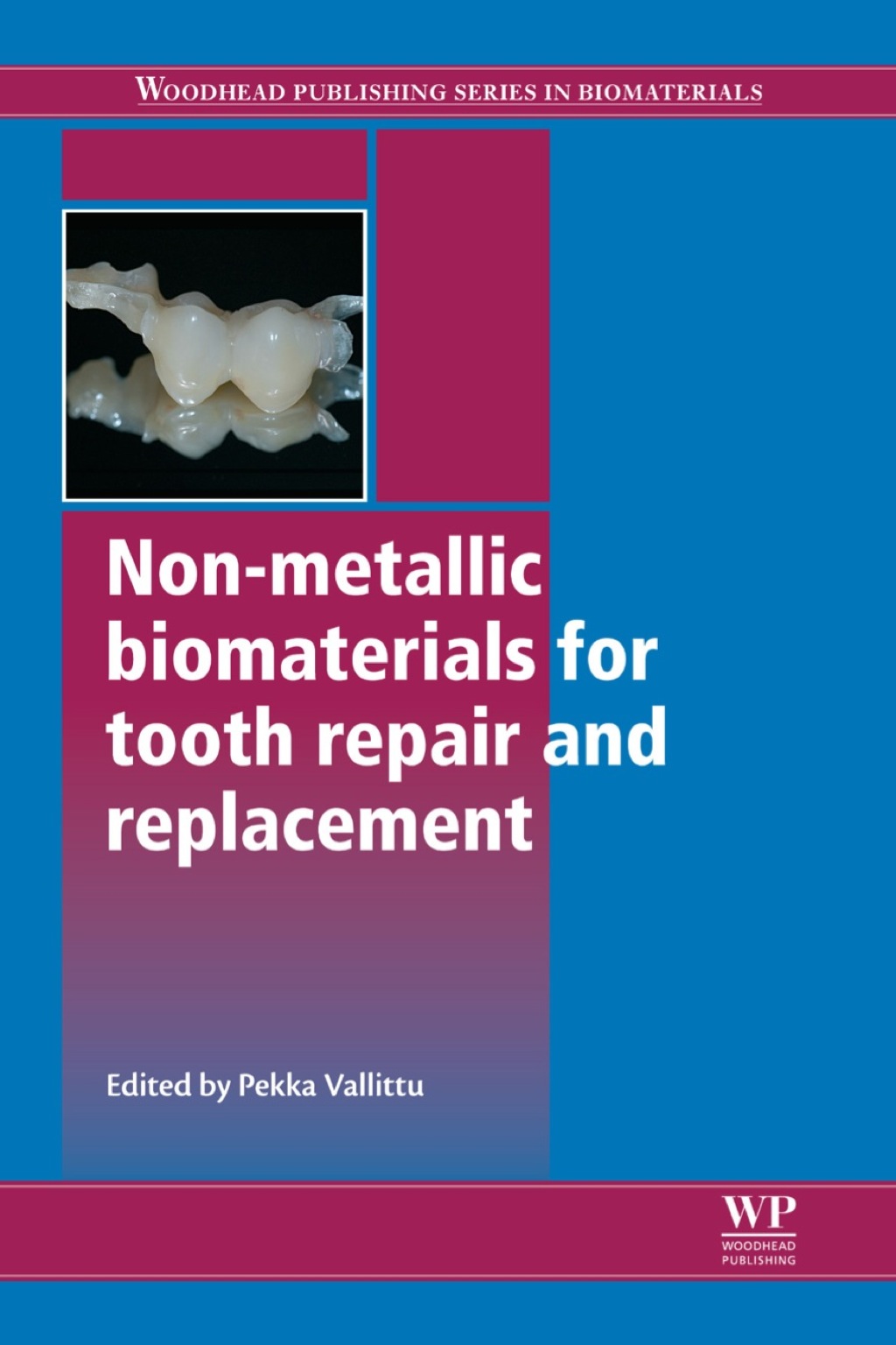 Non-Metallic Biomaterials for Tooth Repair and Replacement 
