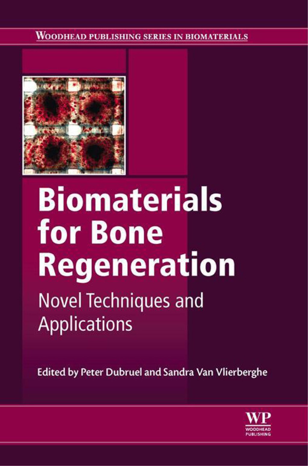 Biomaterials for Bone Regeneration: Novel Techniques and Applications 