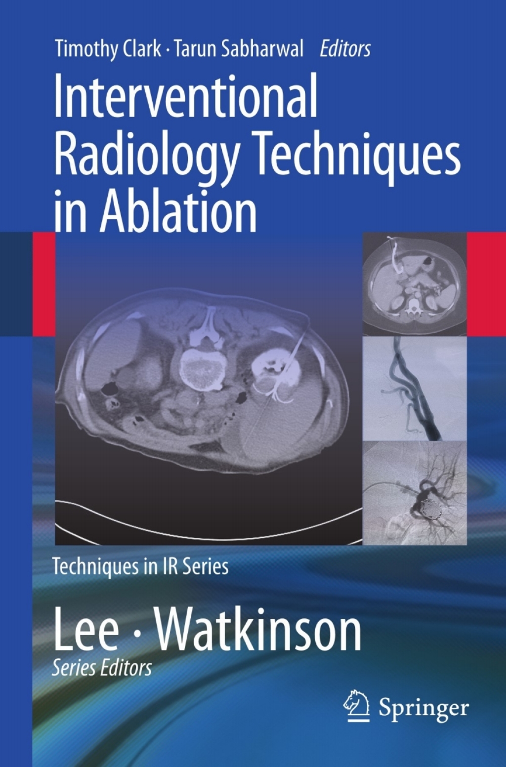 Interventional Radiology Techniques in Ablation 