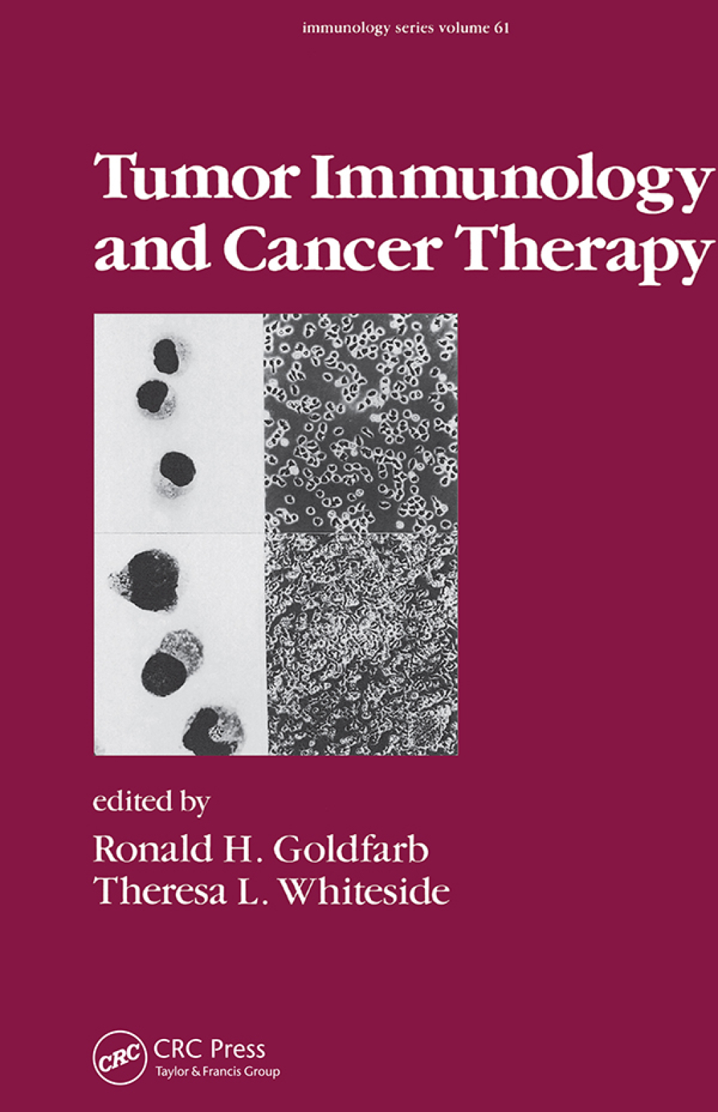 Tumor Immunology and Cancer Therapy 1st Edition