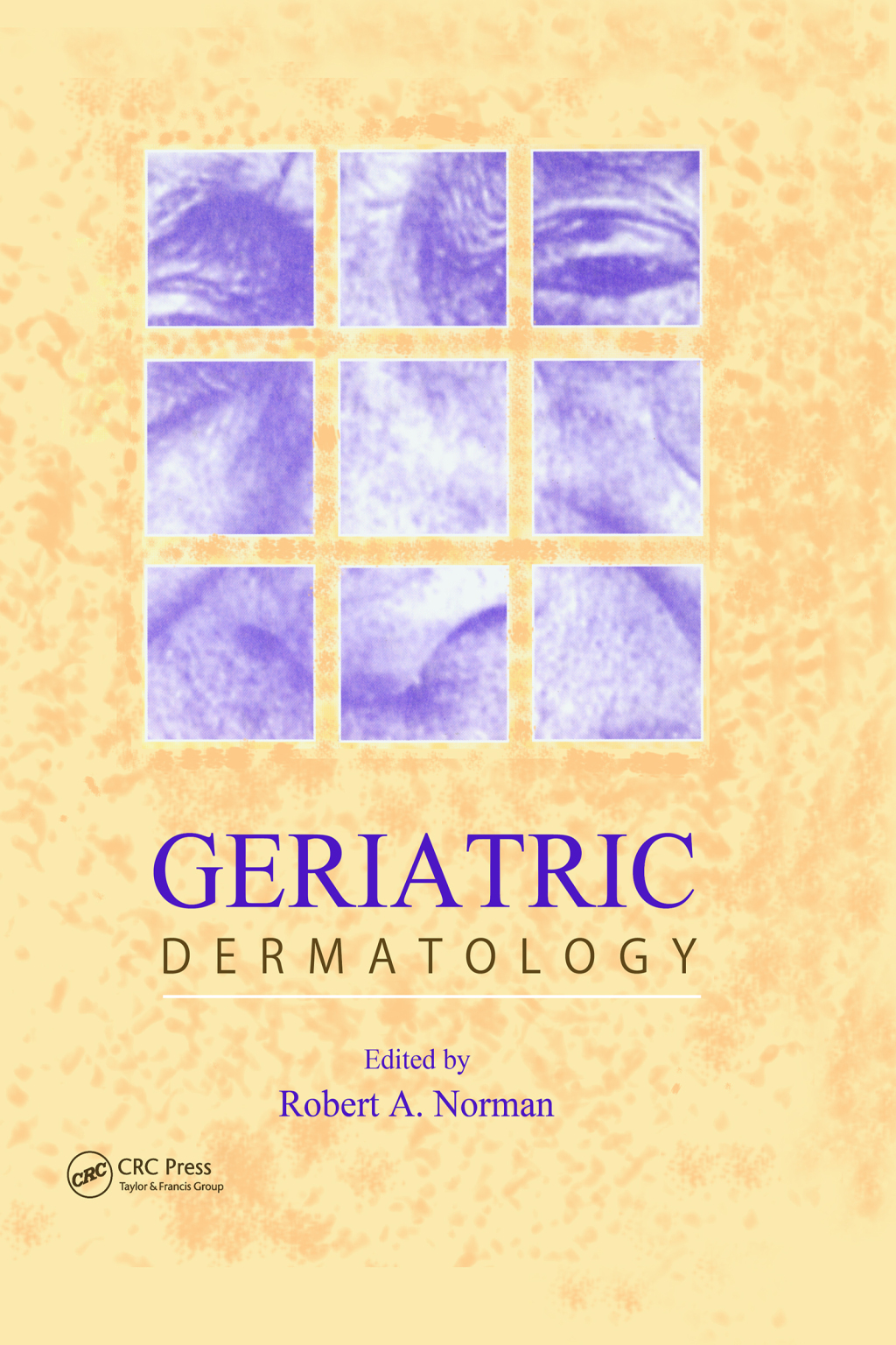 Geriatric Dermatology 1st Edition