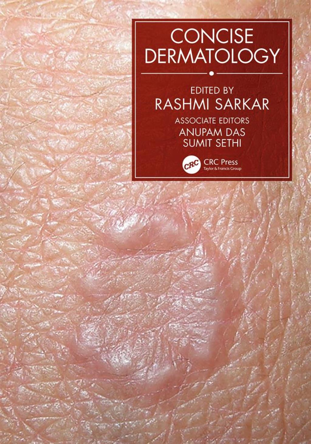 Concise Dermatology 1st Edition