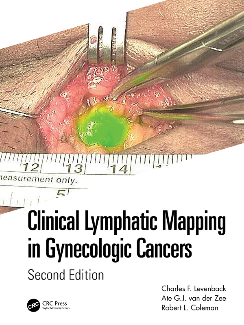 Clinical Lymphatic Mapping in Gynecologic Cancers 2nd Edition
