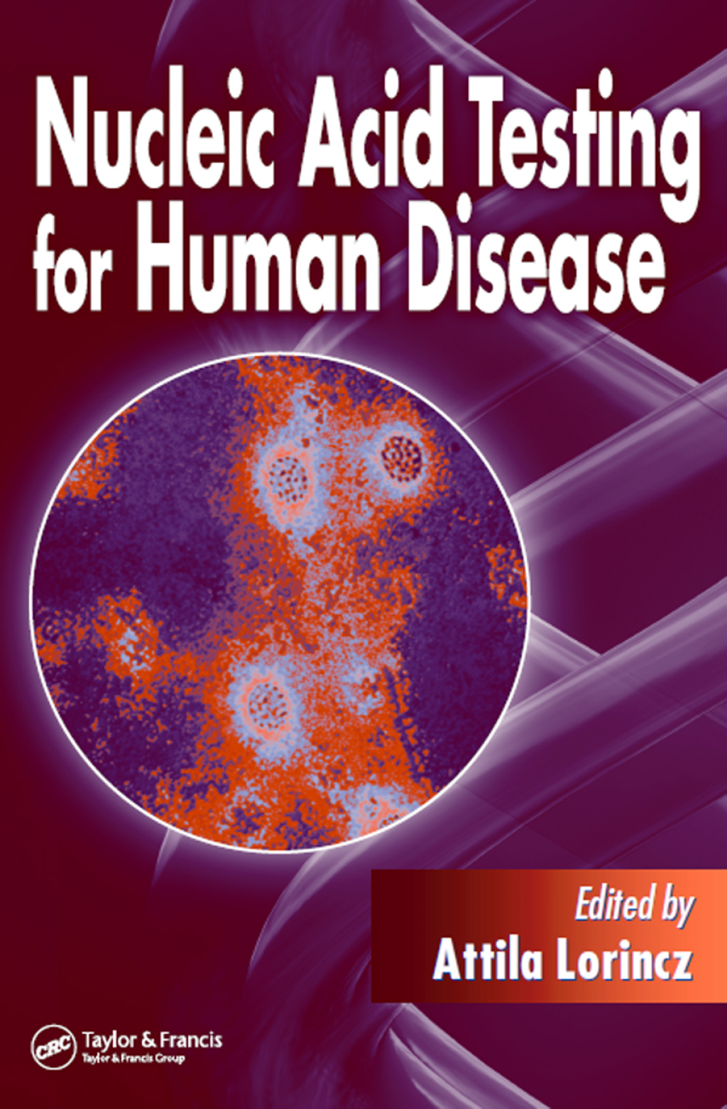 Nucleic Acid Testing for Human Disease 1st Edition