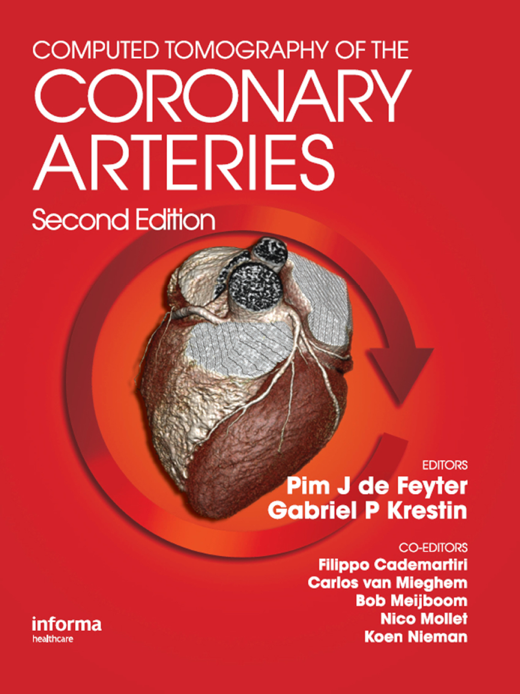 Computed Tomography of the Coronary Arteries 2nd Edition