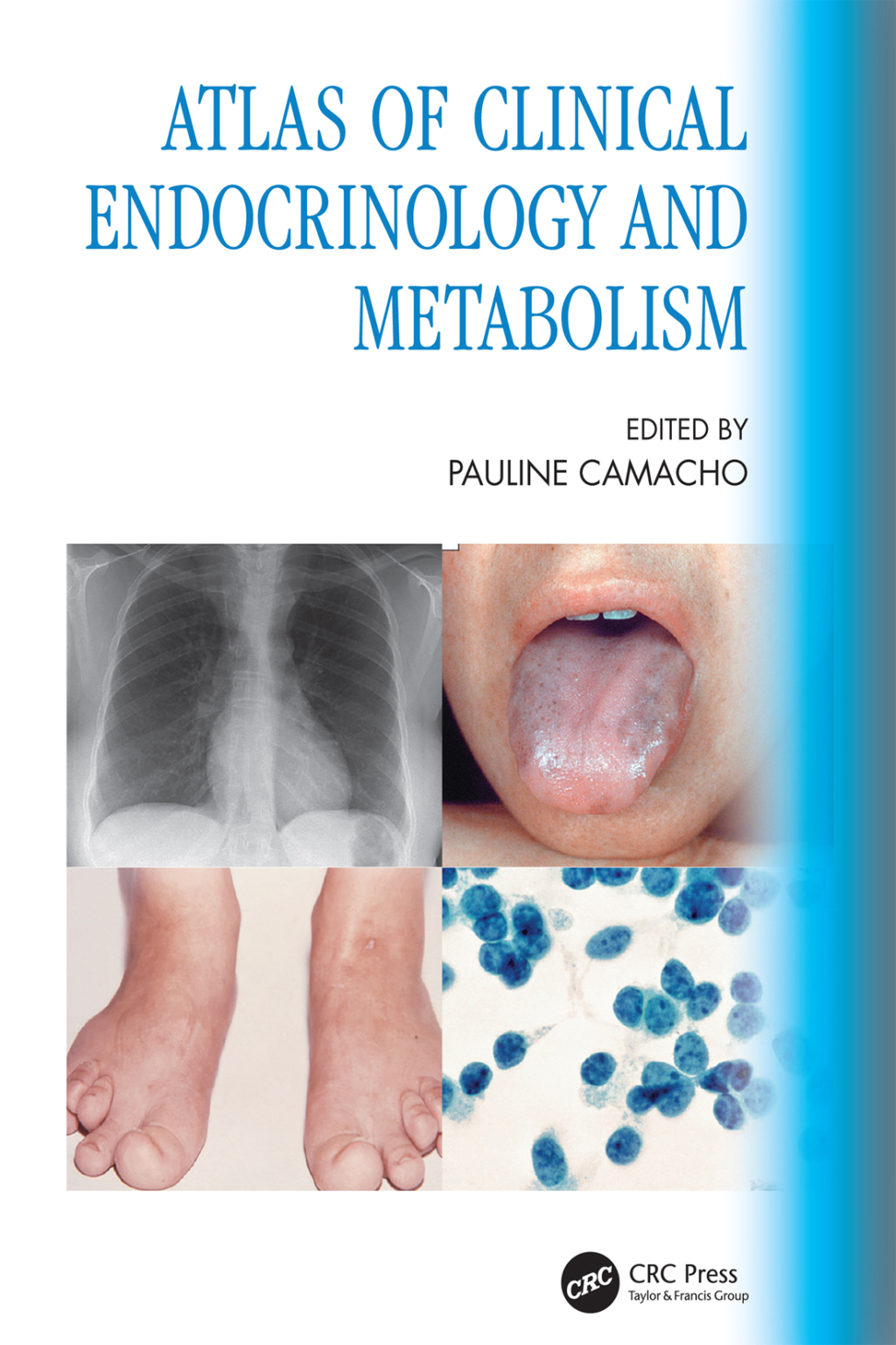 Atlas of Clinical Endocrinology and Metabolism 1st Edition