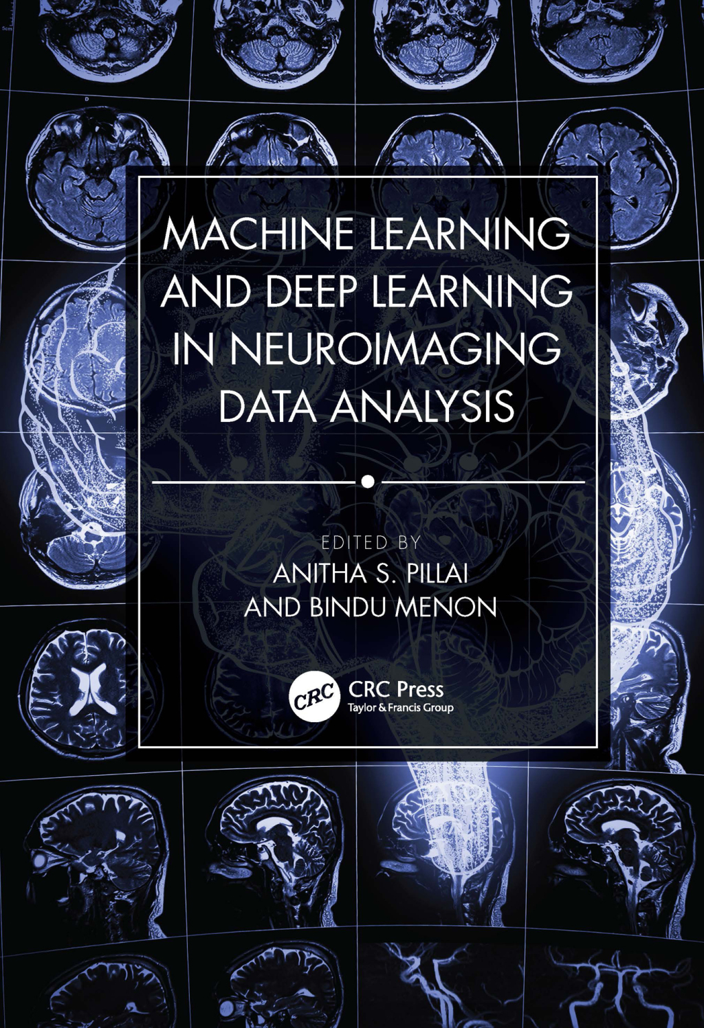 Machine Learning and Deep Learning in Neuroimaging Data Analysis 1st Edition