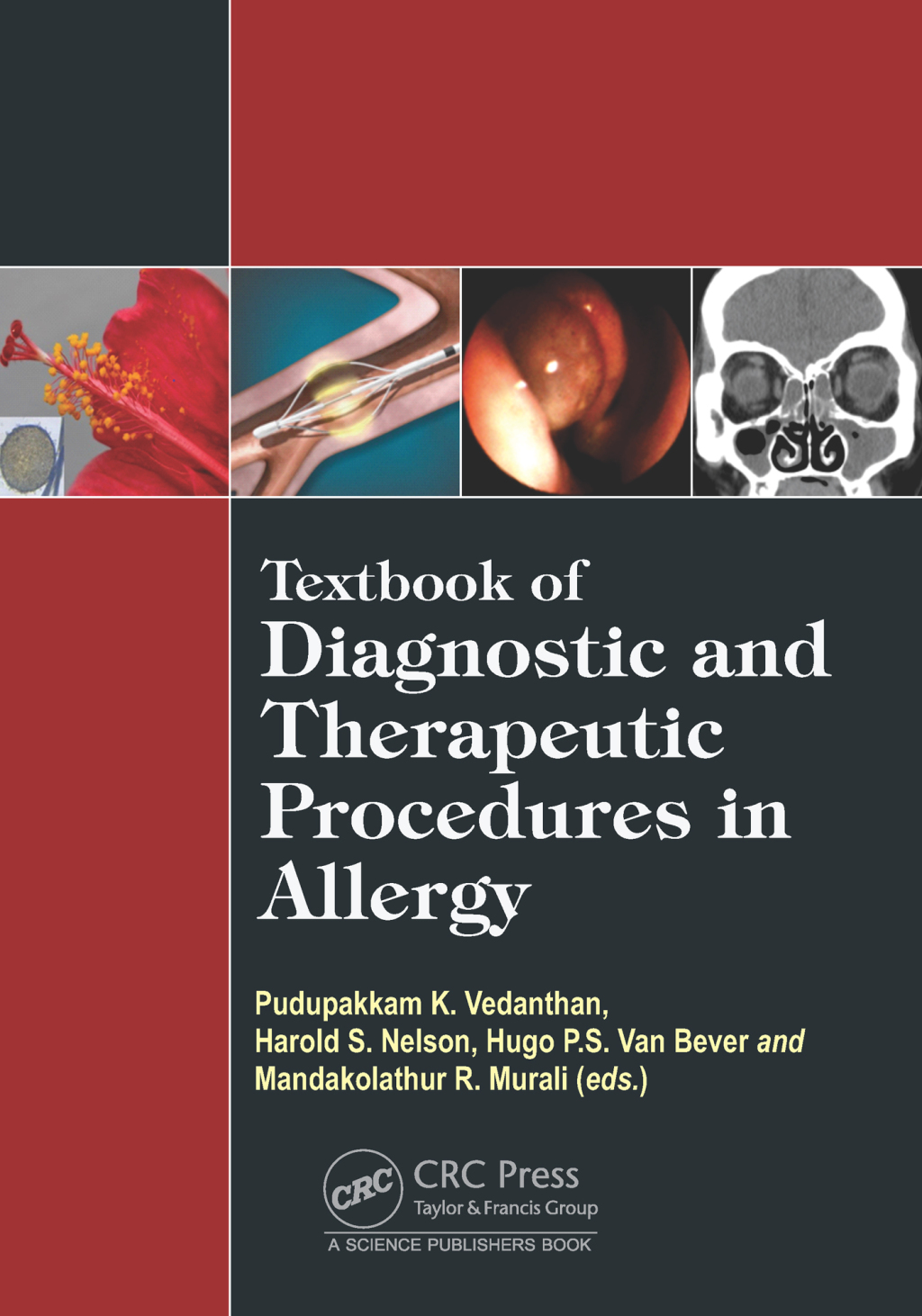 Textbook of Diagnostic and Therapeutic Procedures in Allergy 1st Edition