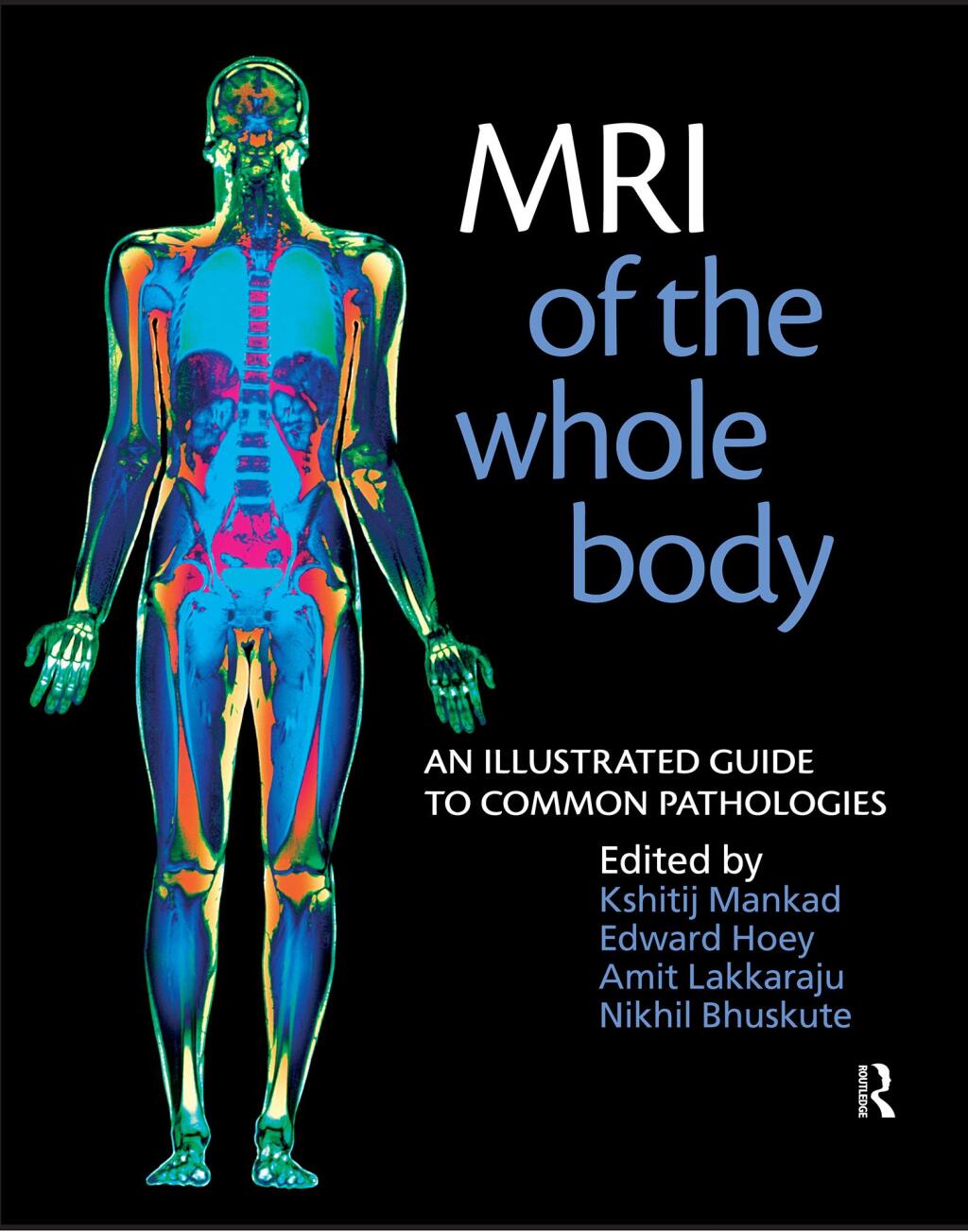 MRI of the Whole Body An Illustrated Guide for Common Pathologies 1st Edition