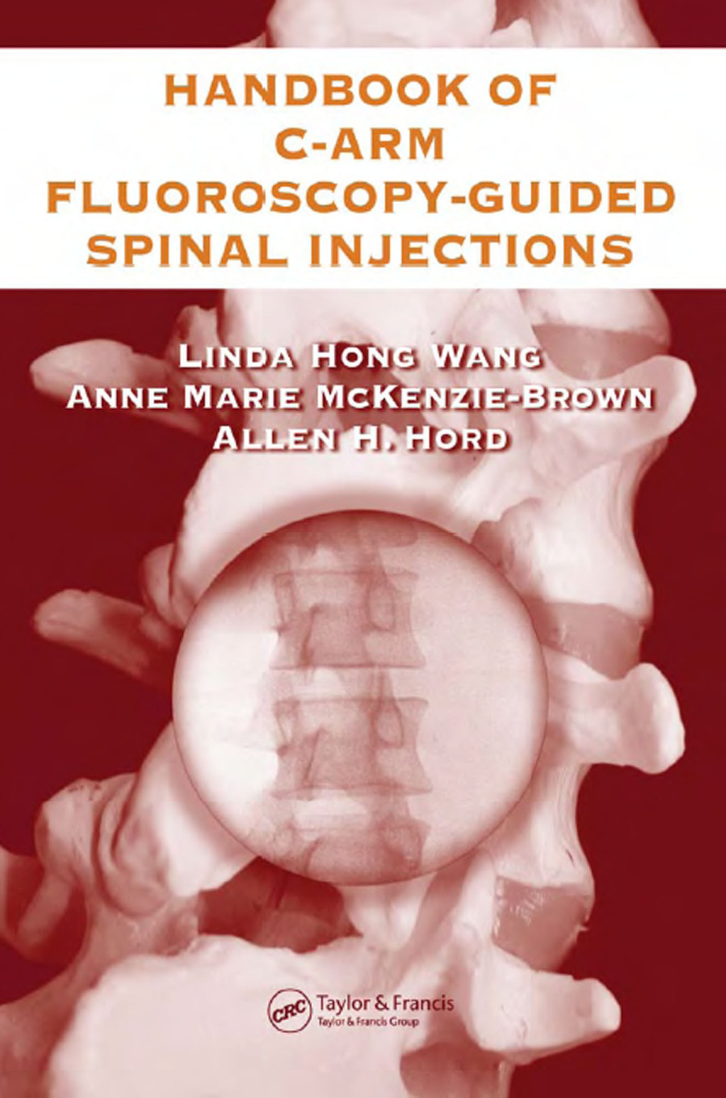The Handbook of C-Arm Fluoroscopy-Guided Spinal Injections 1st Edition