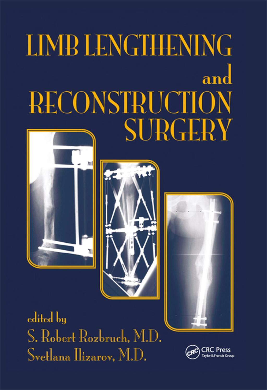 Limb Lengthening and Reconstruction Surgery 1st Edition