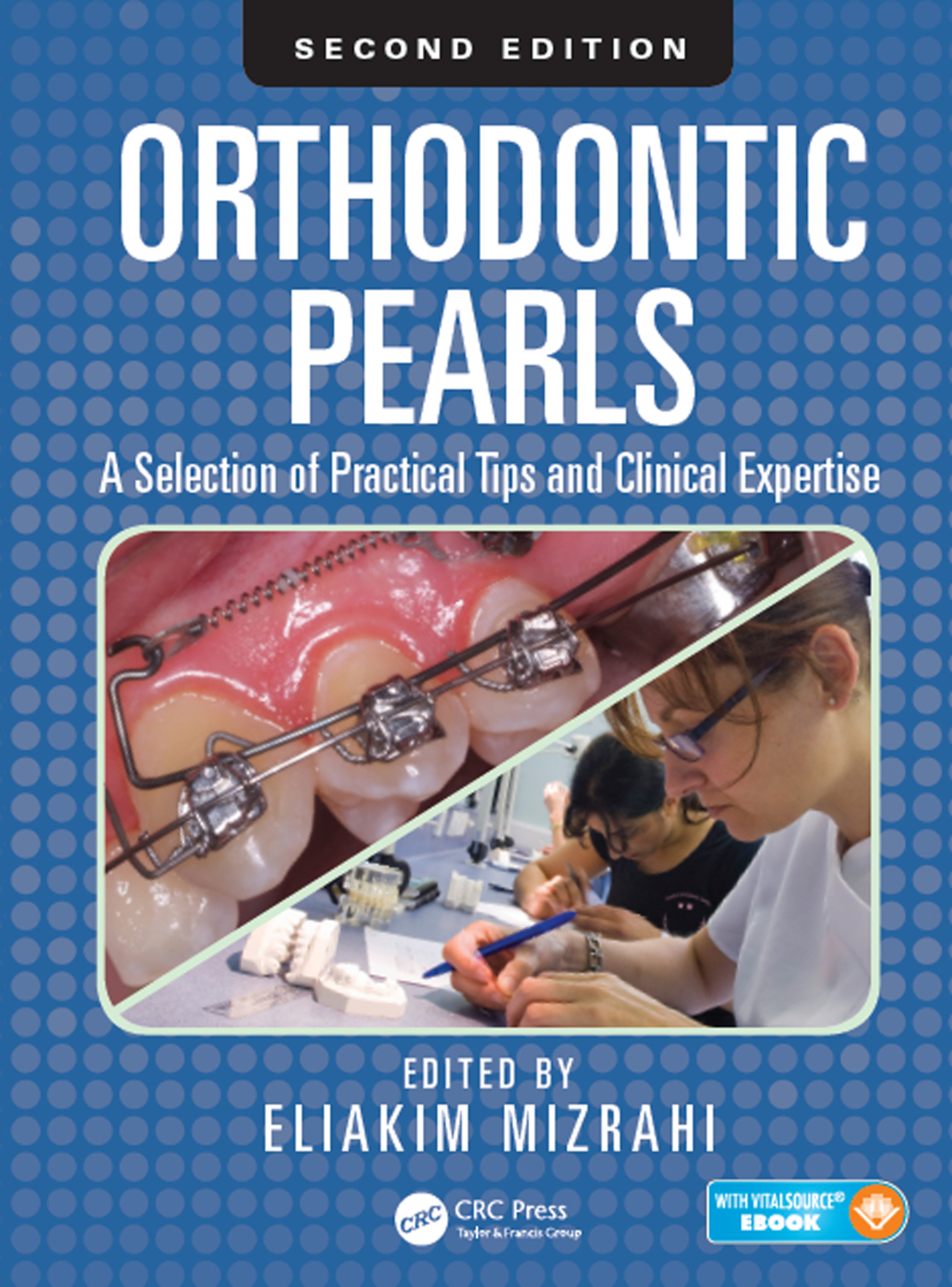 Orthodontic Pearls A Selection of Practical Tips and Clinical Expertise, Second Edition 2nd Edition