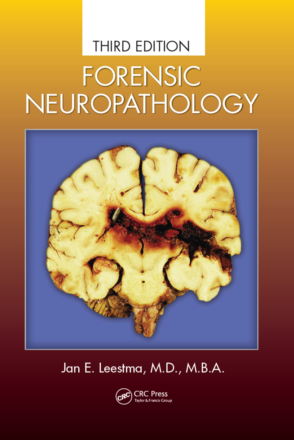 Forensic Neuropathology 3rd Edition