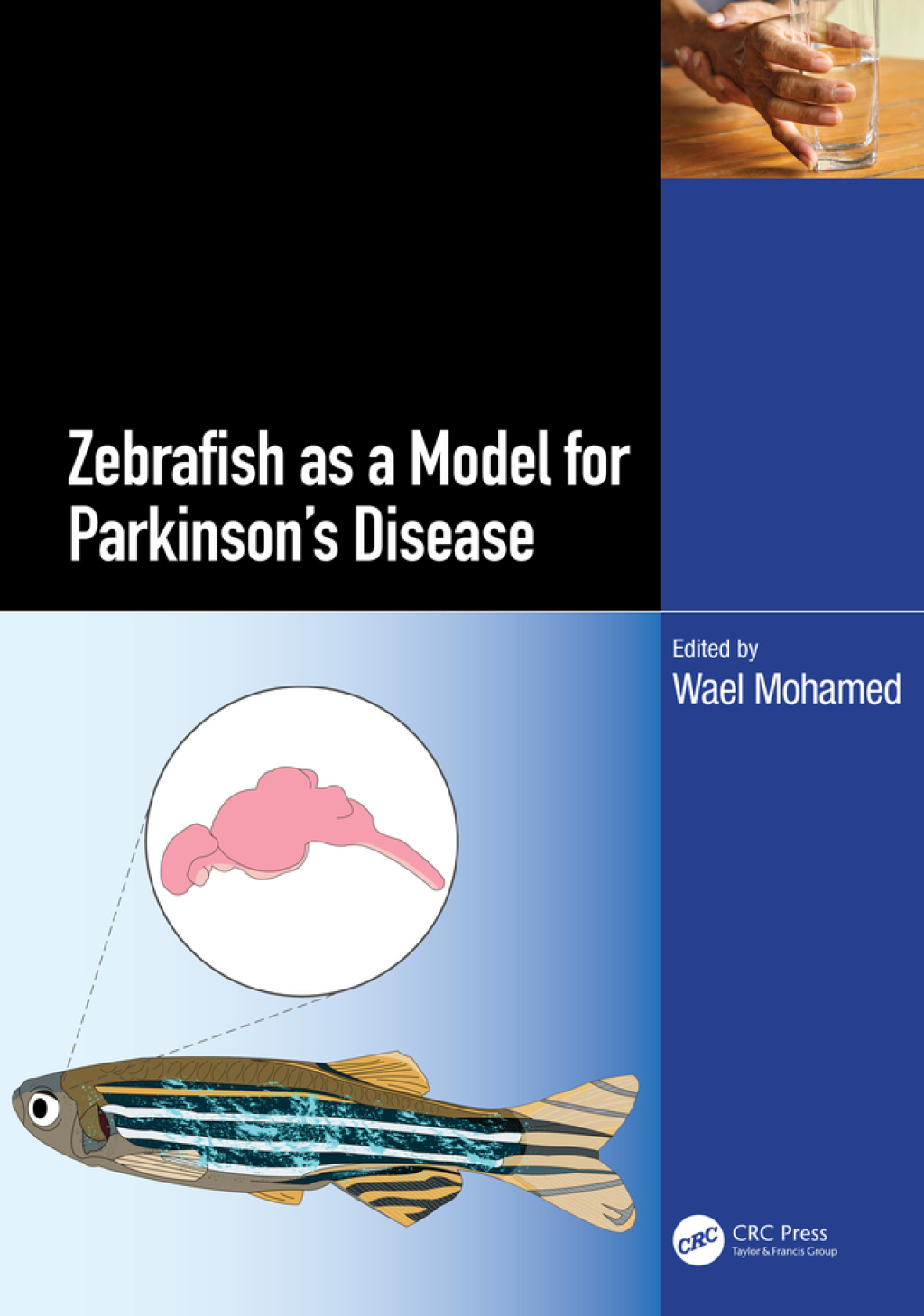 Zebrafish as a Model for Parkinson’s Disease 1st Edition